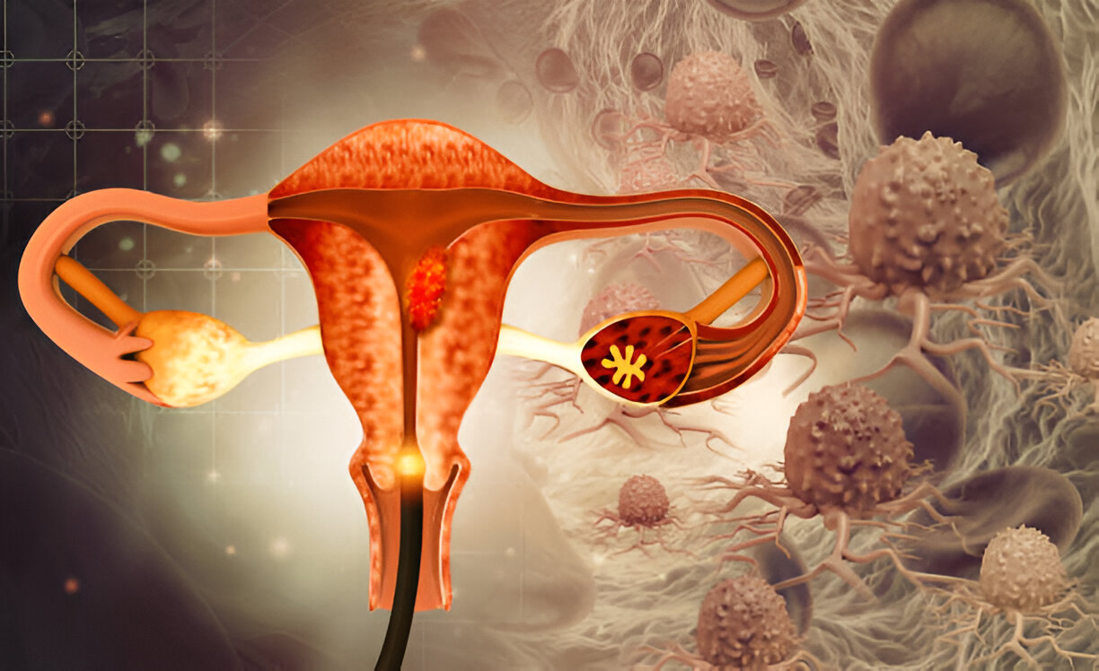 Endometrial Biopsy